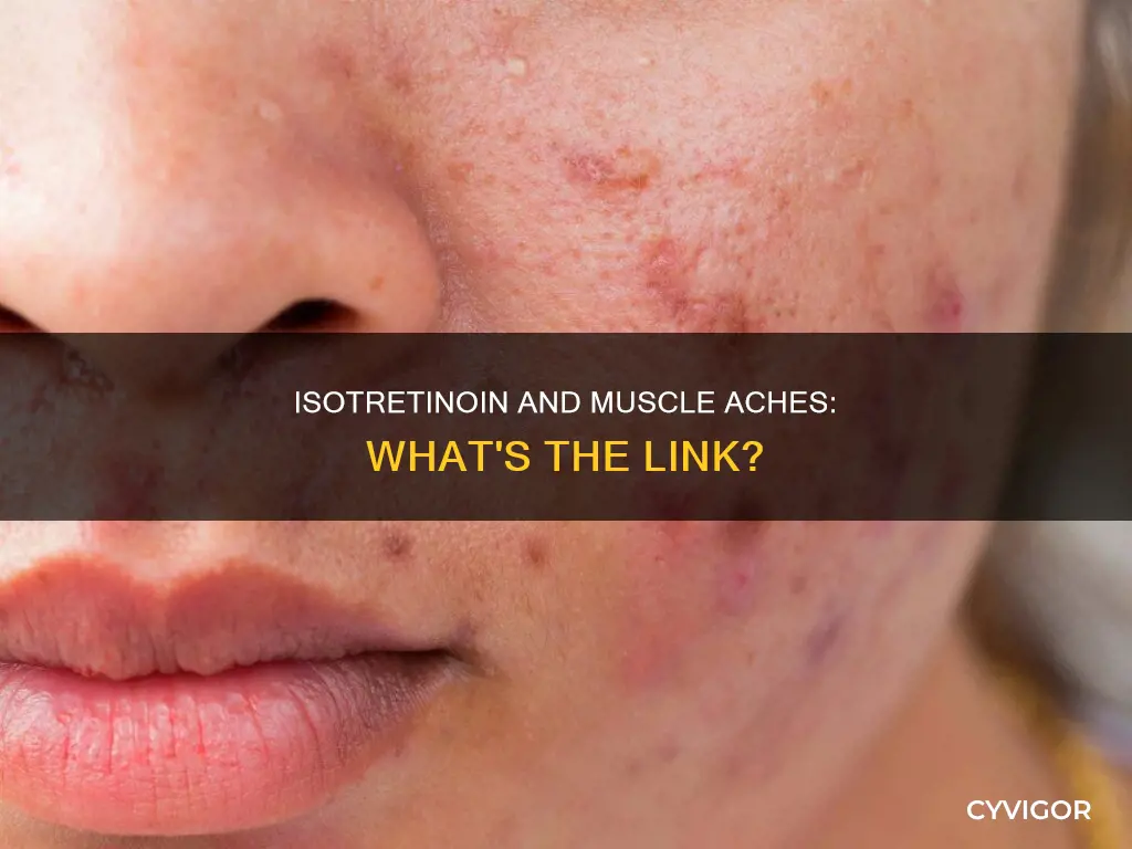 does isotretinoin cause muscle aches