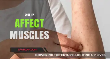 Exploring the Impact of ITP on Muscle Health and Function