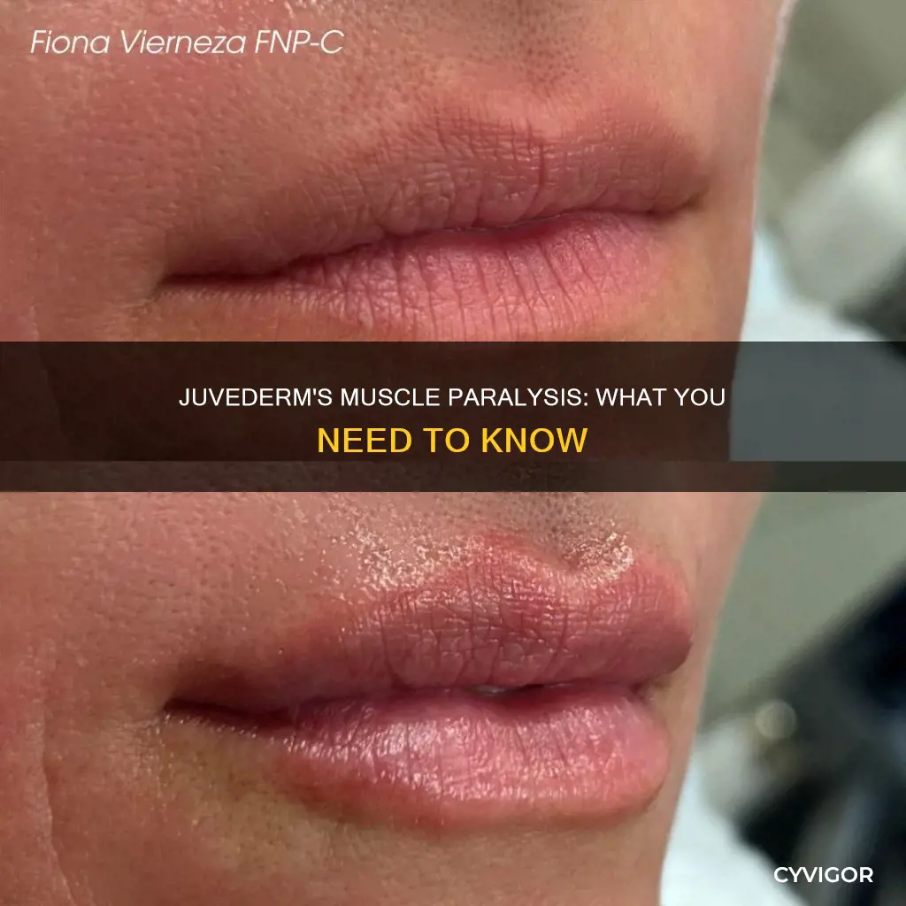 does juvederm paralyze muscles