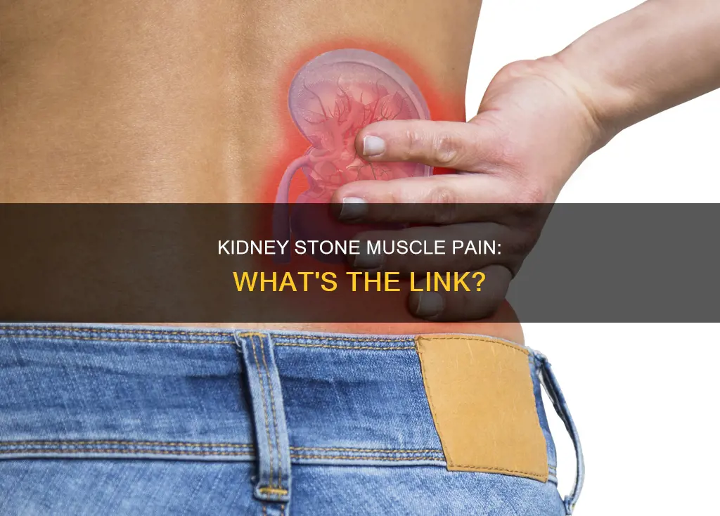 does kidney stone cause muscle pain
