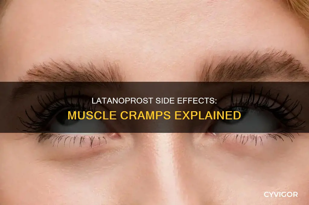 does latanoprost cause muscle cramps