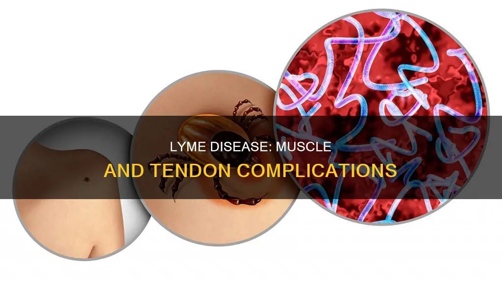 does late lyme disease cause muscle and tendon problems in