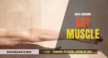 Leukemia's Impact: Can It Eat Away At Muscles?