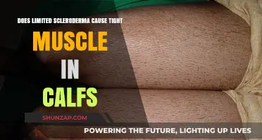 Scleroderma's Impact: Tight Calf Muscles Explained
