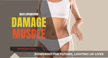 Liposuction: Muscle Damage and Recovery