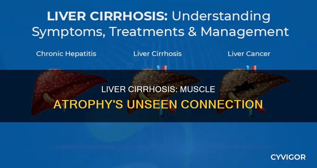 does liver cirrhosis cause muscle atrophy