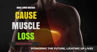 Liver Disease: The Muscle Loss Connection