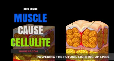 How Muscle Loss Leads to Cellulite Formation