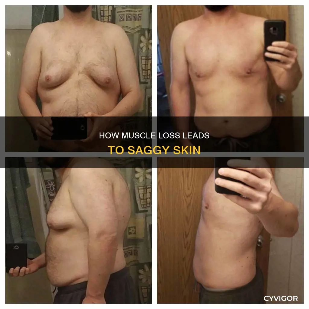 does losing muscle cause saggy skin