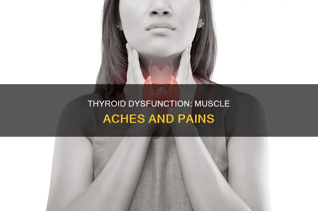 does low thyroid cause muscle aches