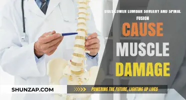 Spinal Fusion: Does it Damage Muscles?