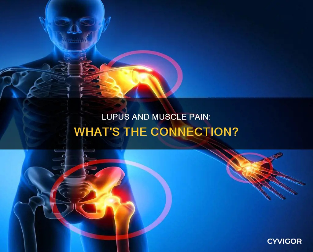 does lupus cause intense muscle pain