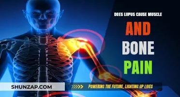 Lupus and Pain: Muscle and Bone Aches Explained