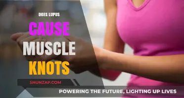 Lupus and Muscle Knots: What's the Link?