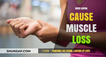 Lupus and Muscle Loss: What's the Connection?
