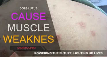 Lupus and Muscle Weakness: What's the Link?