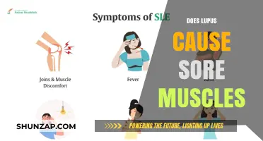 Lupus and Sore Muscles: What's the Connection?