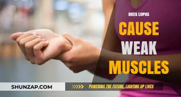 Lupus and Weak Muscles: What's the Connection?