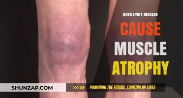 Lyme Disease: Can It Cause Muscle Atrophy?