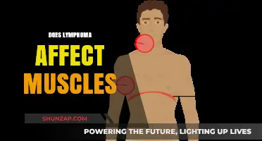 Understanding Lymphoma's Impact on Muscle Health and Function