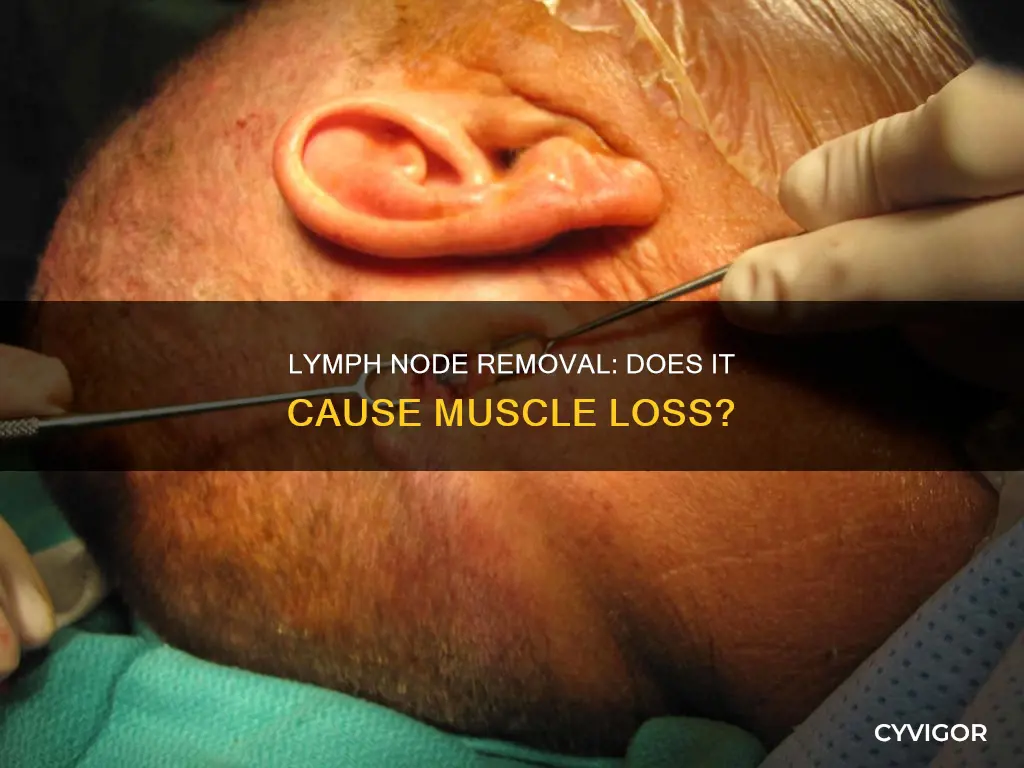 does lympth node removel cause muscle loss