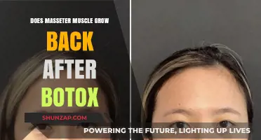 Regrowth of Masseter Muscle Post-Botox: Facts and Timeline