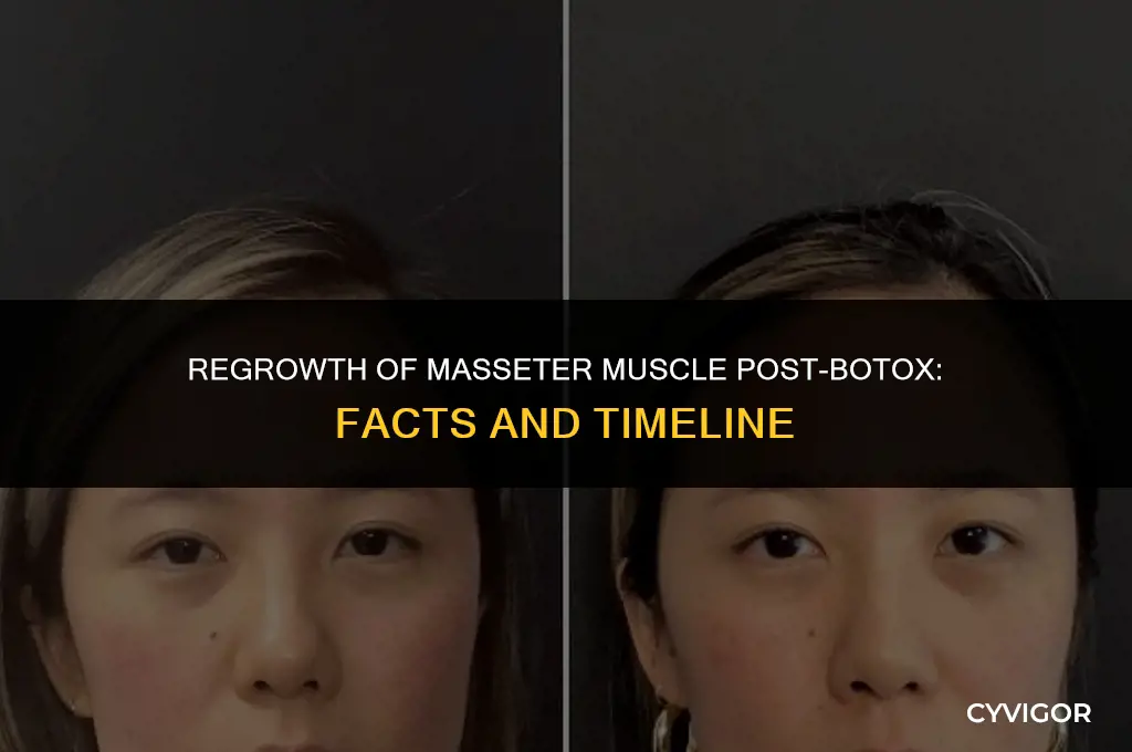 does masseter muscle grow back after botox
