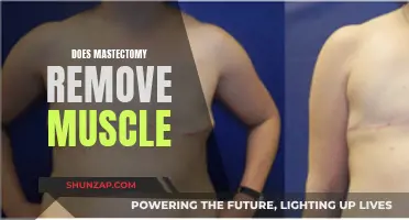 Mastectomy and Muscle: What's the Procedure's Impact?
