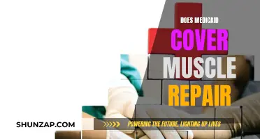 Muscle Repair and Medicaid: What's Covered?