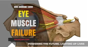Migraine and Eye Muscle Failure: What's the Link?