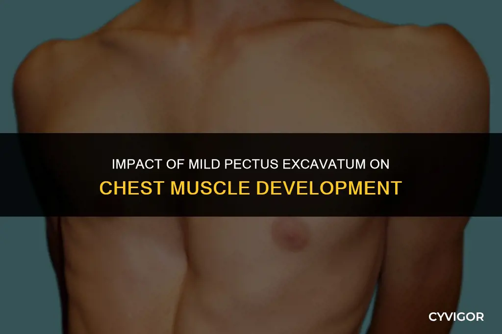 does minor pectus excavatum affect chest muscles