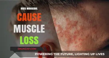 Minoxidil's Muscle Loss: Fact or Fiction?