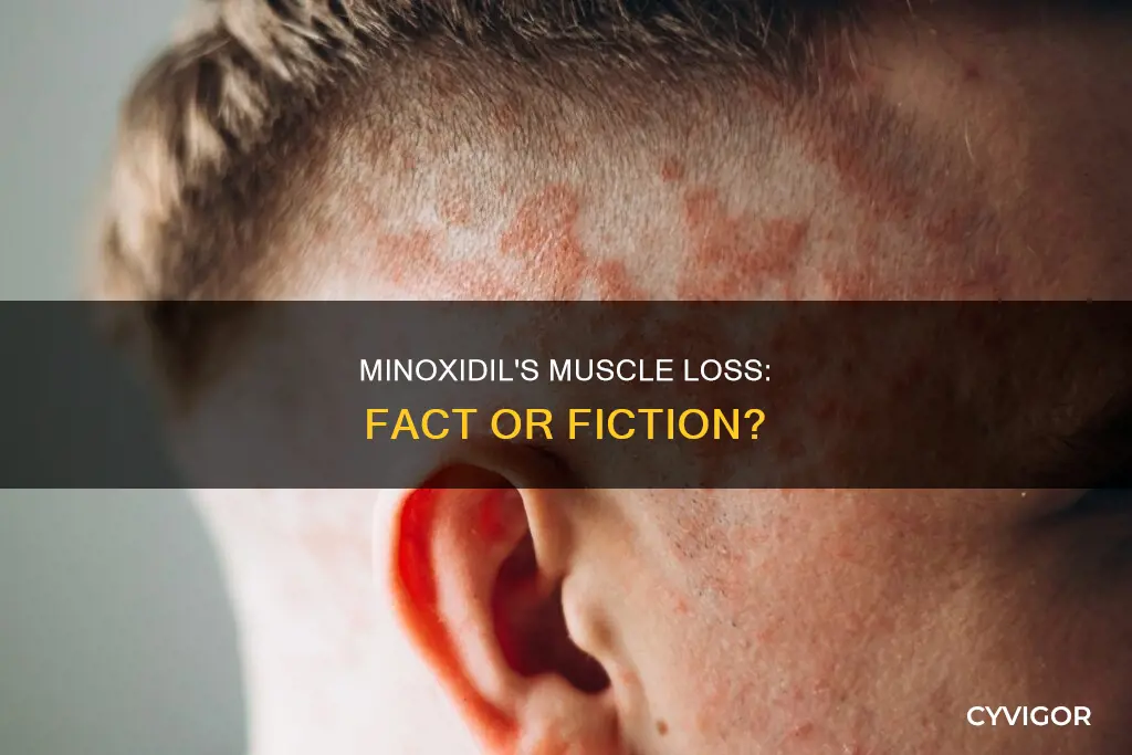 does minoxidil cause muscle loss
