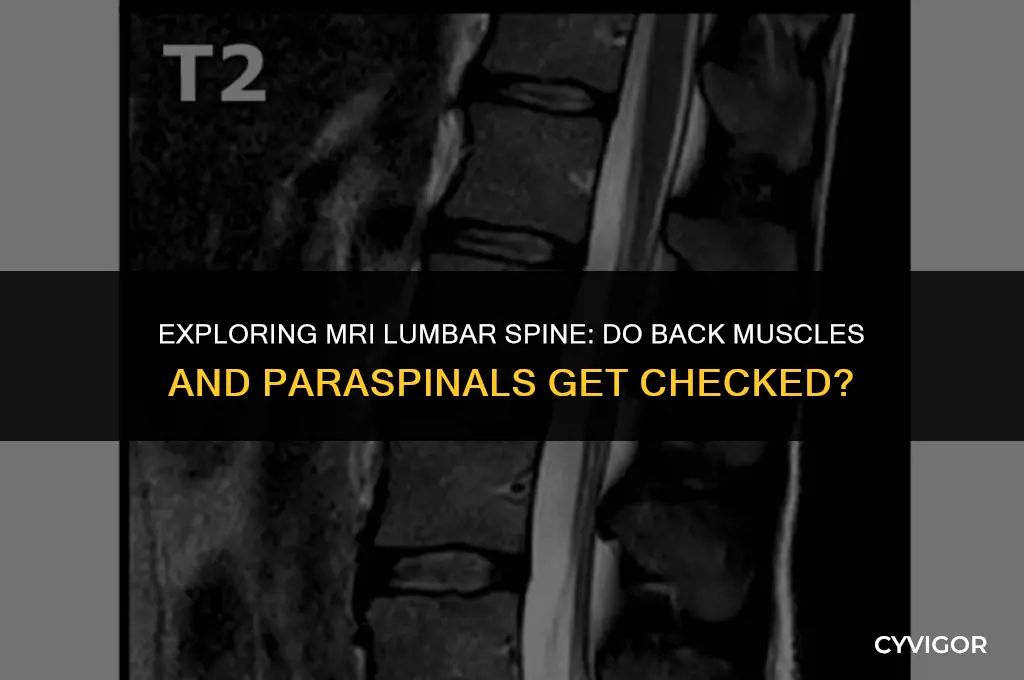 does mri lumbar spine look at back muscles paraspinal