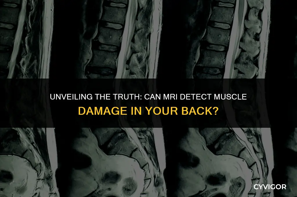 does mri show muscle damage in back