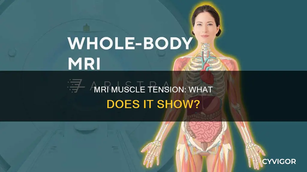 does mri show muscle tension