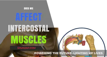 Exploring the Impact of Multiple Sclerosis on Intercostal Muscles