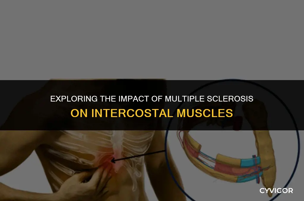 does ms affect intercostal muscles