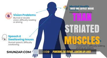 Beyond Striations: The Widespread Impact of Multiple Sclerosis