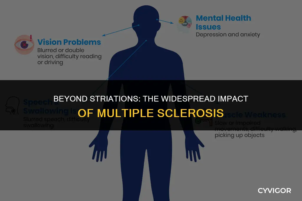 does ms affect more than striated muscles
