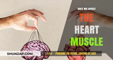 Exploring the Impact of Multiple Sclerosis on Cardiac Health