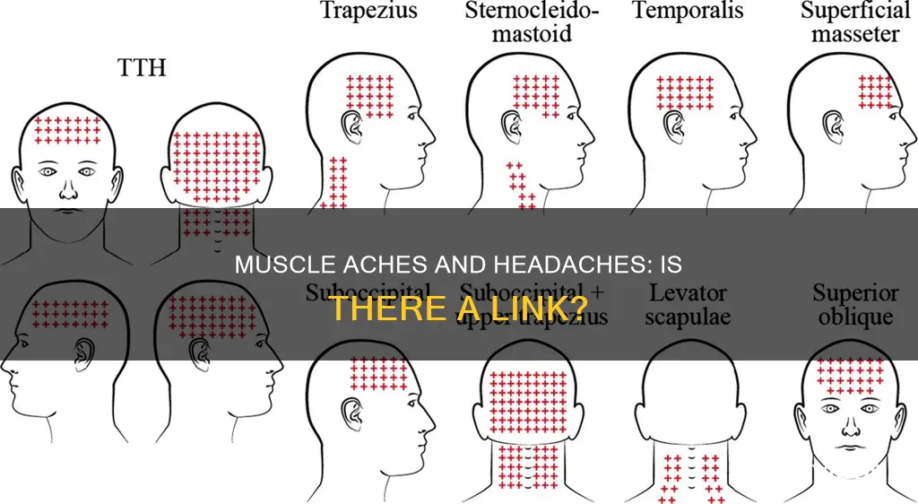 does muscle aches cause headaches