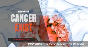 Muscle Cancer: A Real Threat or Myth?