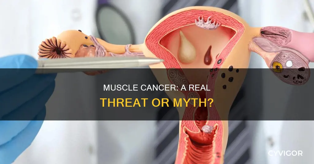 does muscle cancer exist
