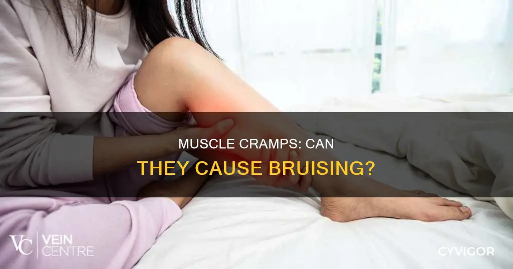 does muscle cramp cause bruising