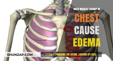 Chest Muscle Cramps: A Surprising Cause of Edema?