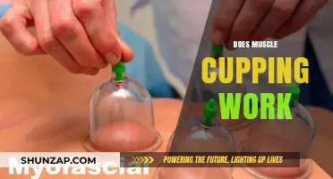 Does Muscle Cupping Work? Uncovering the Truth Behind This Ancient Therapy
