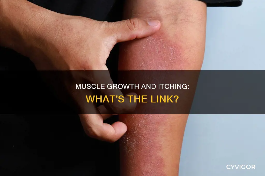 does muscle growth cause itching