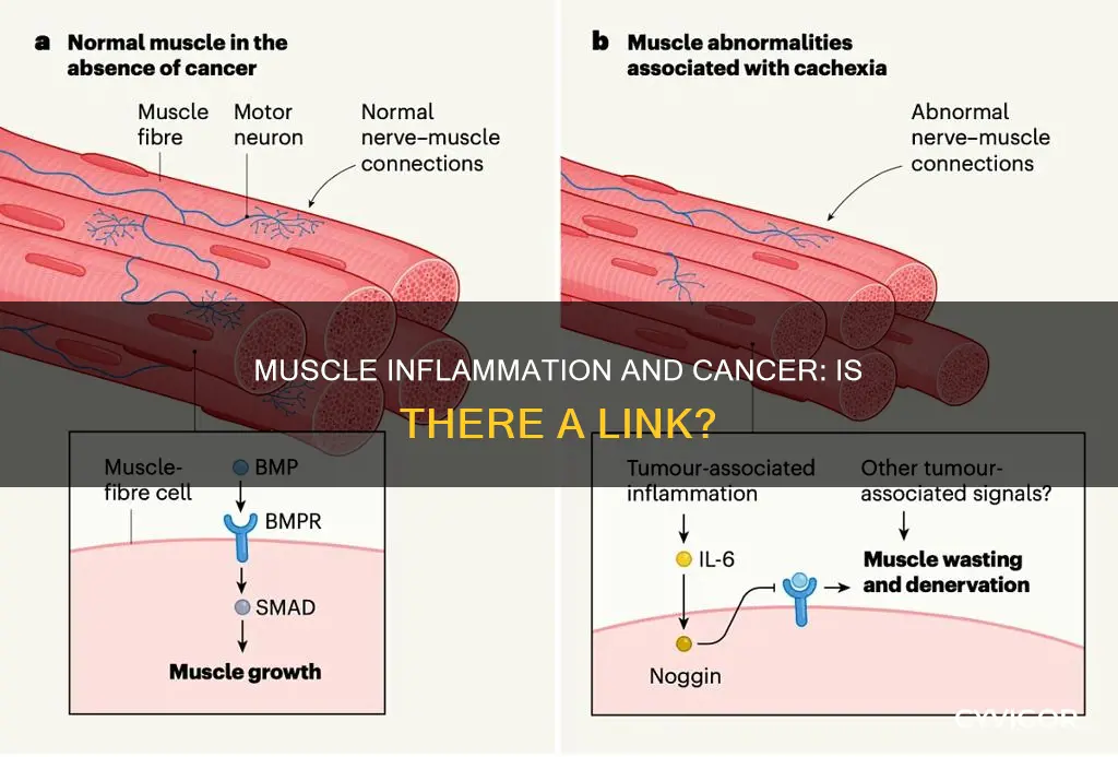 does muscle inflammation cause cancer
