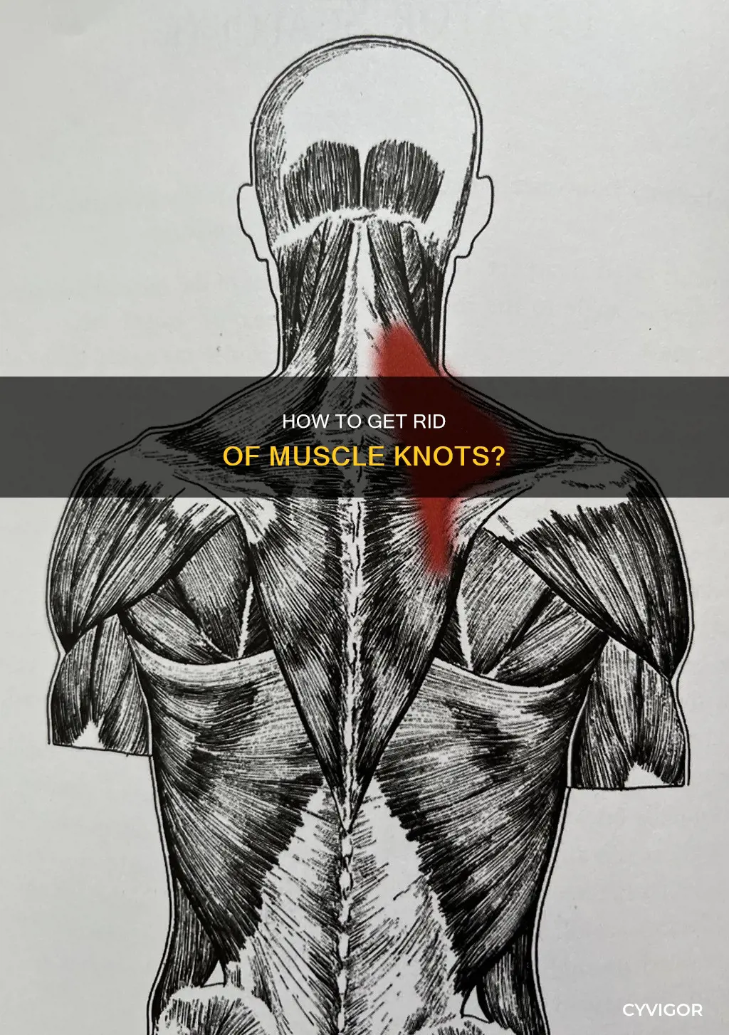does muscle knots go away
